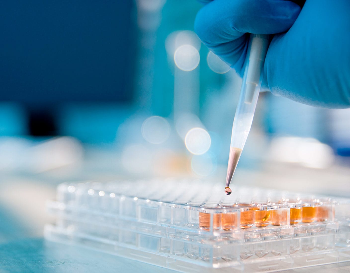 A person wearing a blue glove uses a pasteur pipette to transfer liquid into smaller sample tubes arranged in a tray.